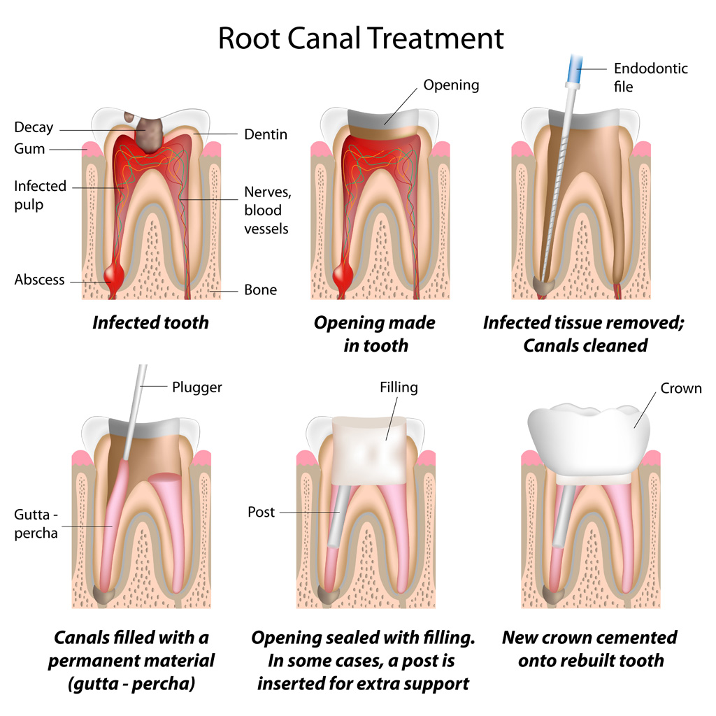 Best Dental Clinics in Chennai