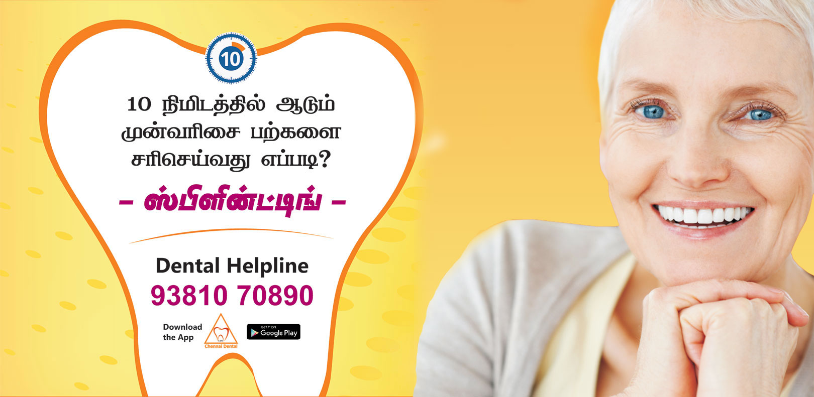 Best Dentist in Chennai
